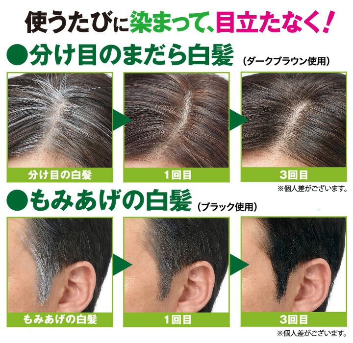 ���K�w�A�J���[�X�e�B�b�N